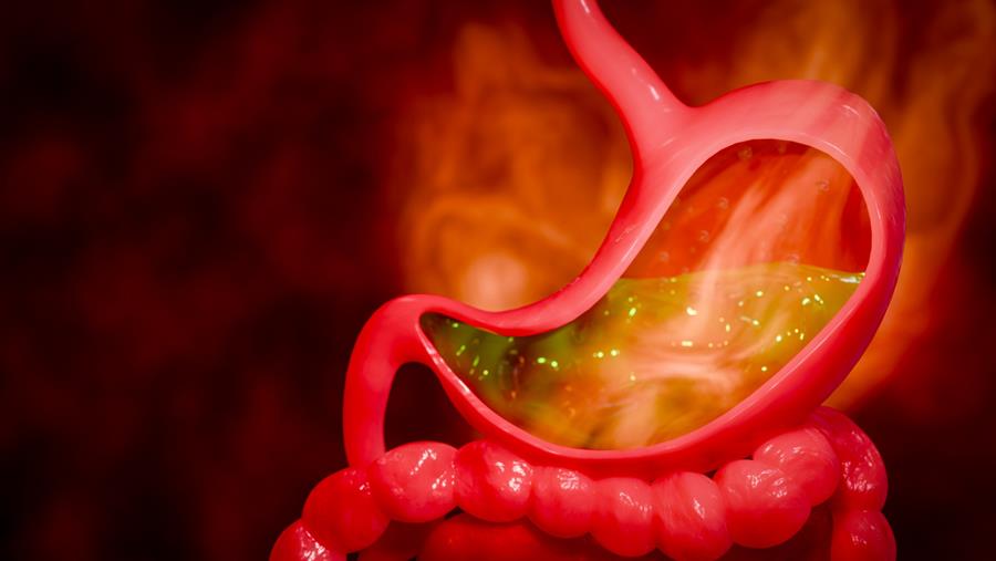 Gastrites, gastropathies : comment les distinguer ?